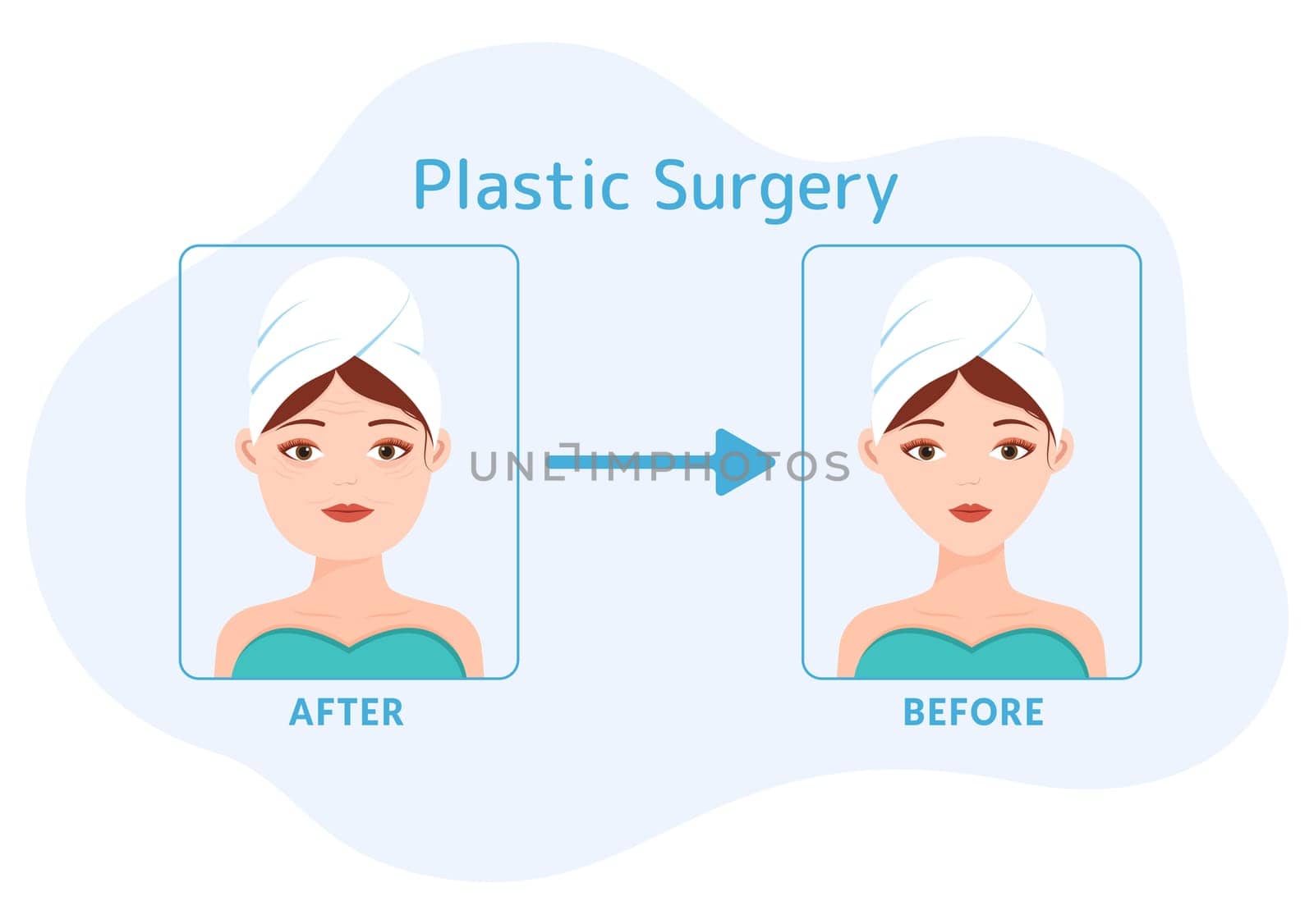Plastic Surgery Flat Cartoon Hand Drawn Templates Illustration of Medical Surgical Operation on the Body or Face as Expected using Advanced Equipment