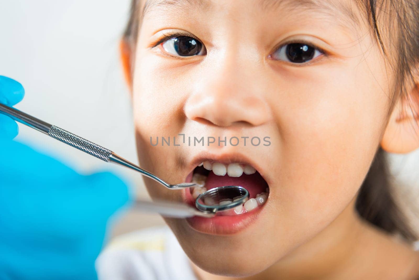 Dental kid health examination. Asian dentist making examination procedure for cute little girl open mouth, Doctor examines oral cavity of little child uses mouth mirror to checking teeth cavity