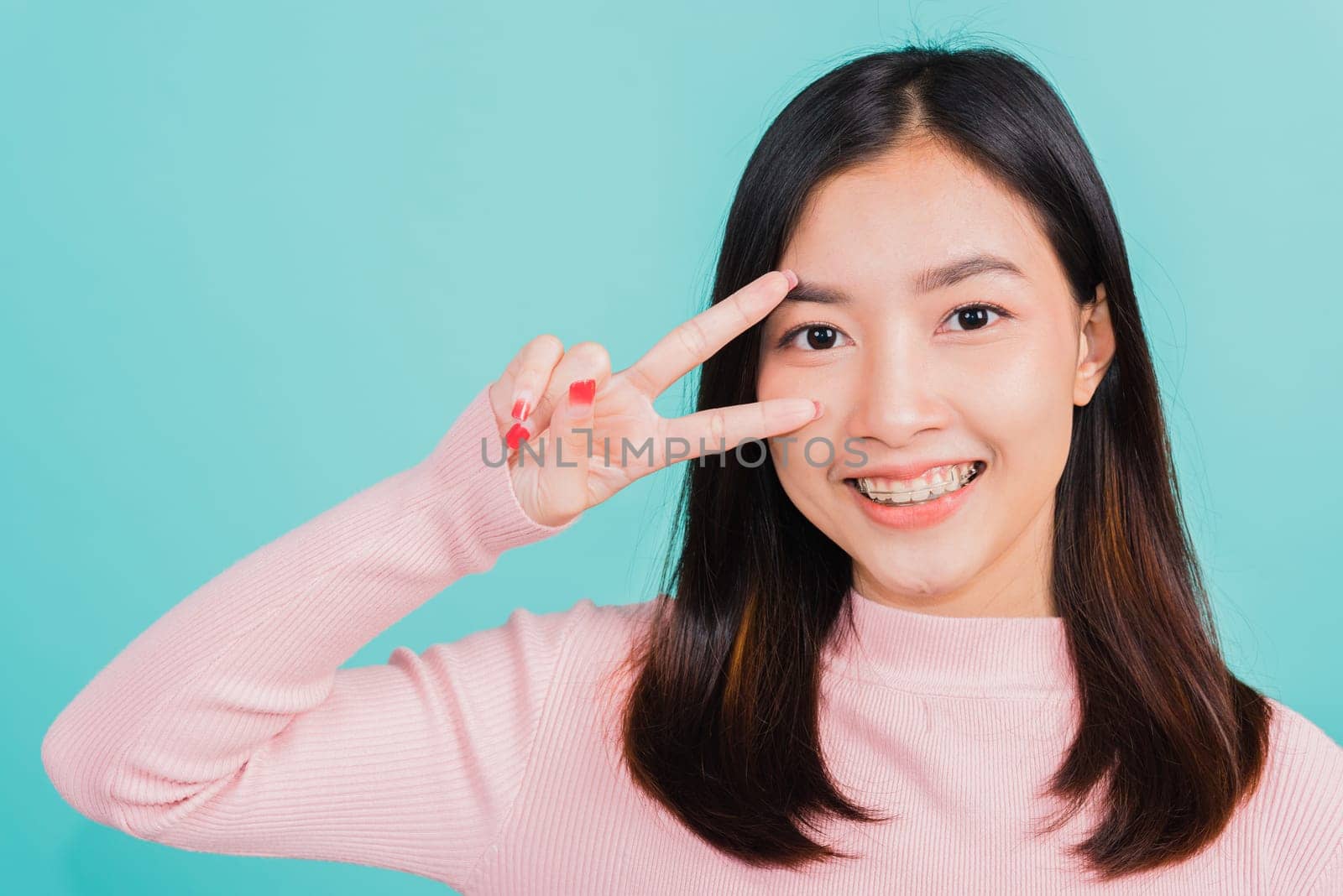 Asian beautiful woman smiling wear silicone orthodontic retainers on teeth showing v-sign victory finger near eye isolated on blue background, retaining after removable braces. Dental hygiene concept