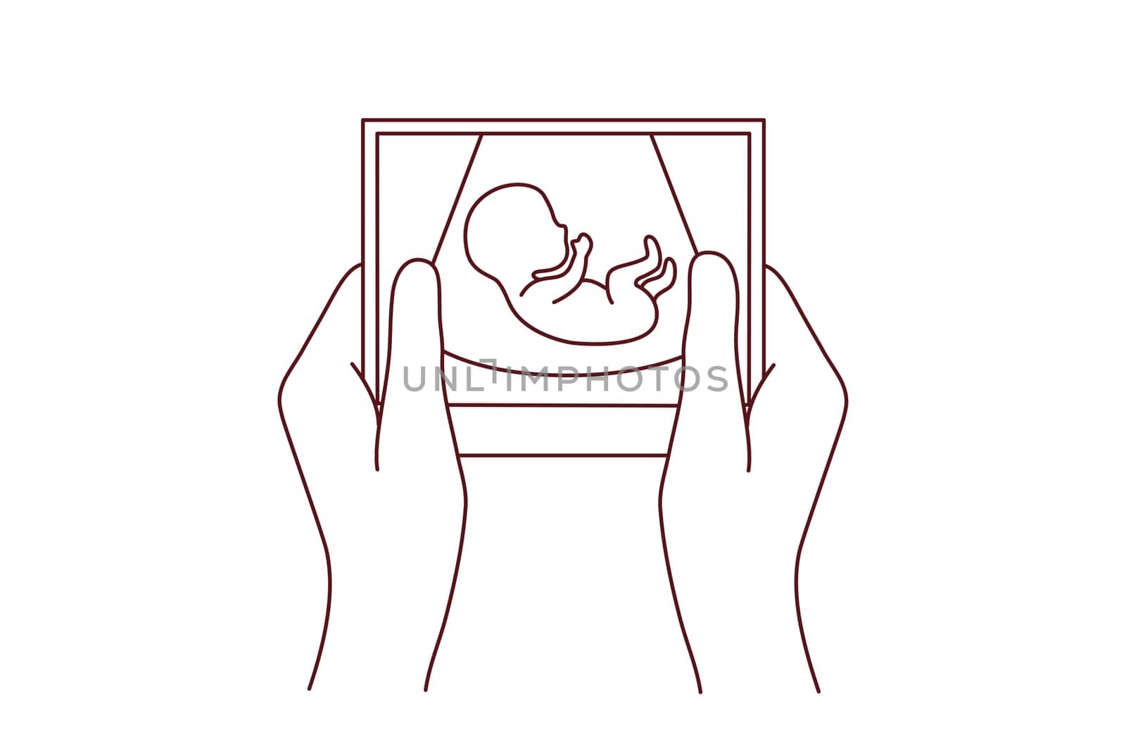 Hands of person holding scan of embryo waiting for baby birth. Future mother with ultrasound picture of baby. Motherhood concept. Vector illustration.
