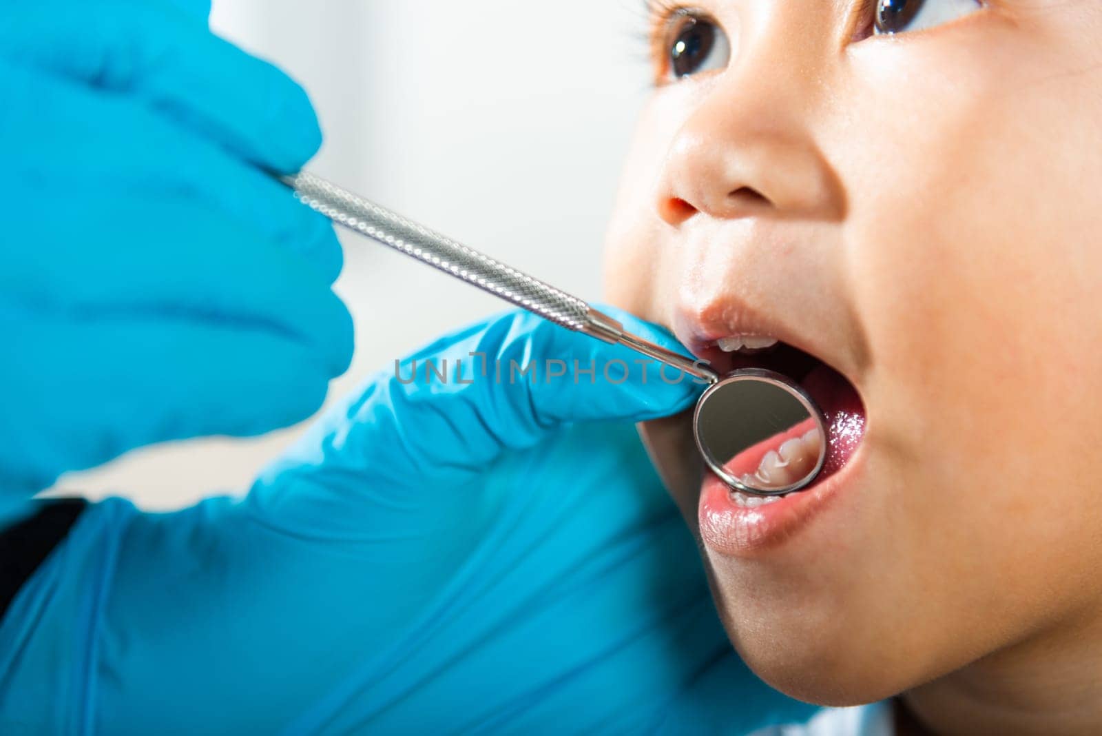Dental kid health examination. Asian dentist making examination procedure for cute little girl open mouth, Doctor examines oral cavity of little child uses mouth mirror to checking teeth cavity