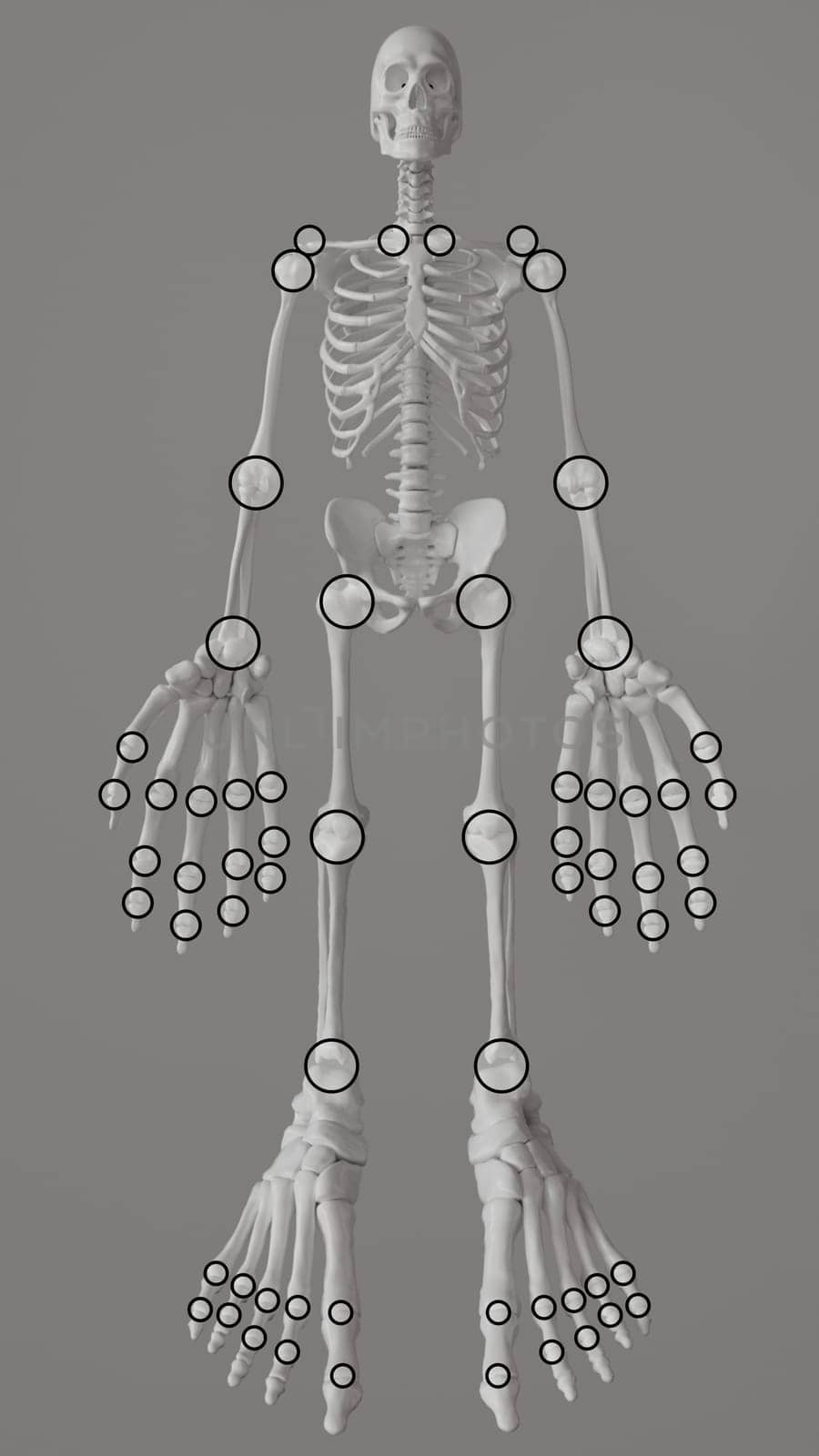 Joint manikin for determining painful swollen joints -- 3D rendering