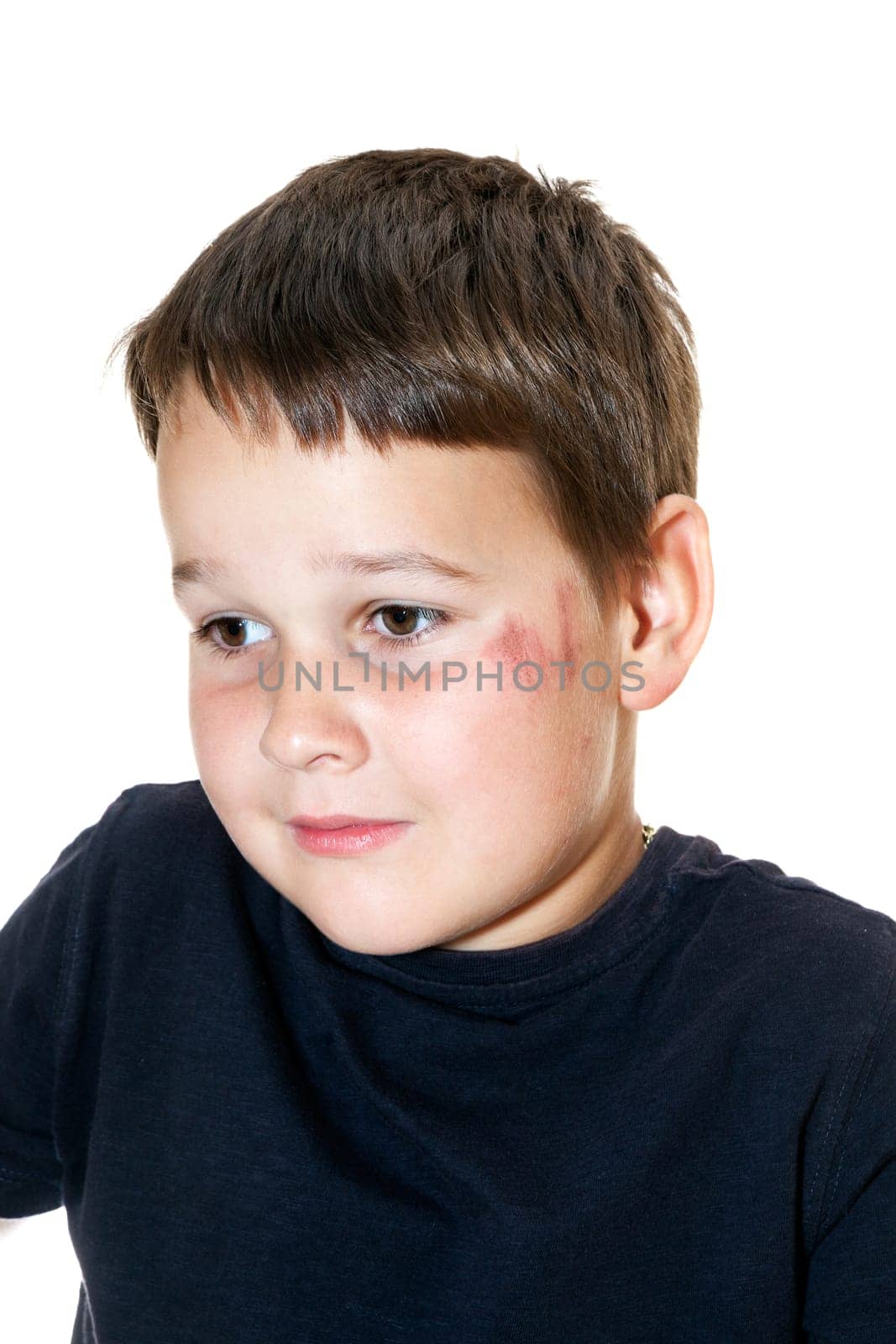 sad boy with a scraped face