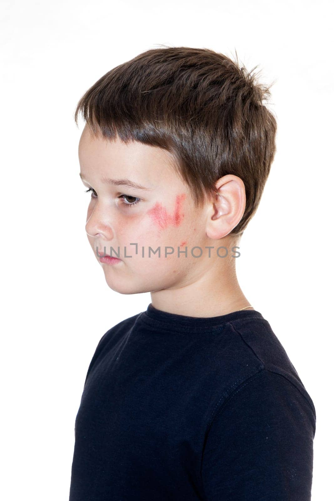 sad boy with a scraped face