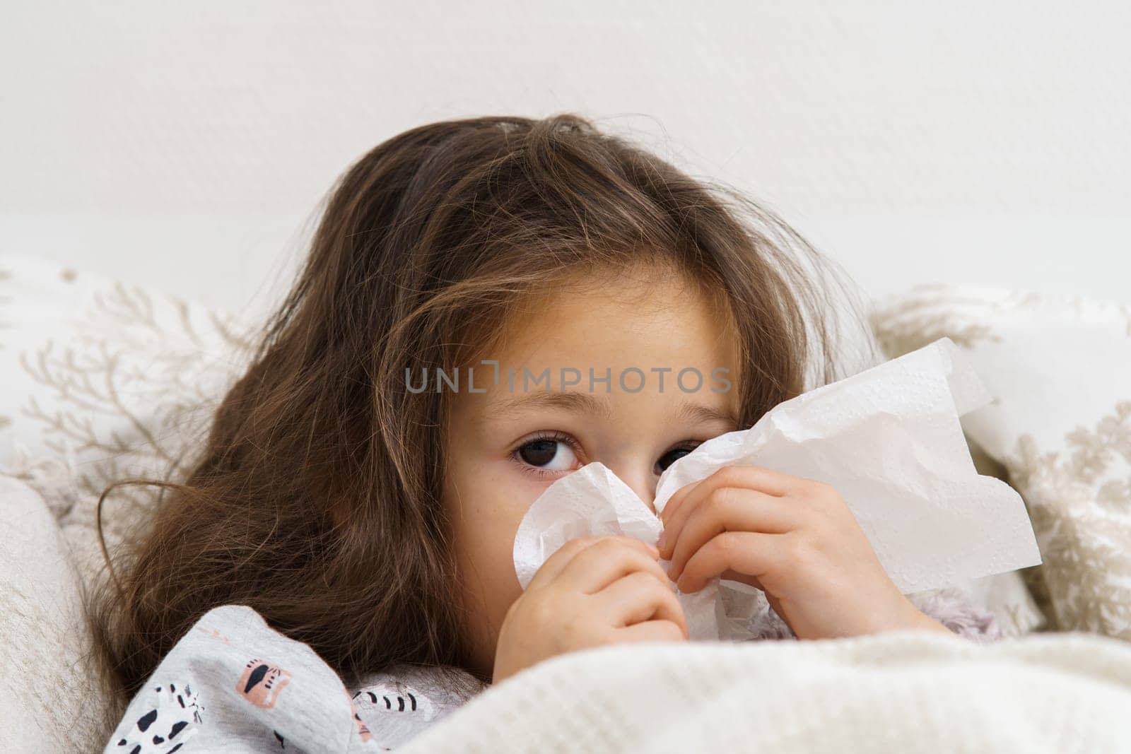 Adorable, feared little brunette girl blowing nose with tissues, look camera, lying in blanket on bed. Allergy season, contagious disease. Bedtime at home. Headache and seasonal allergy. Copy space