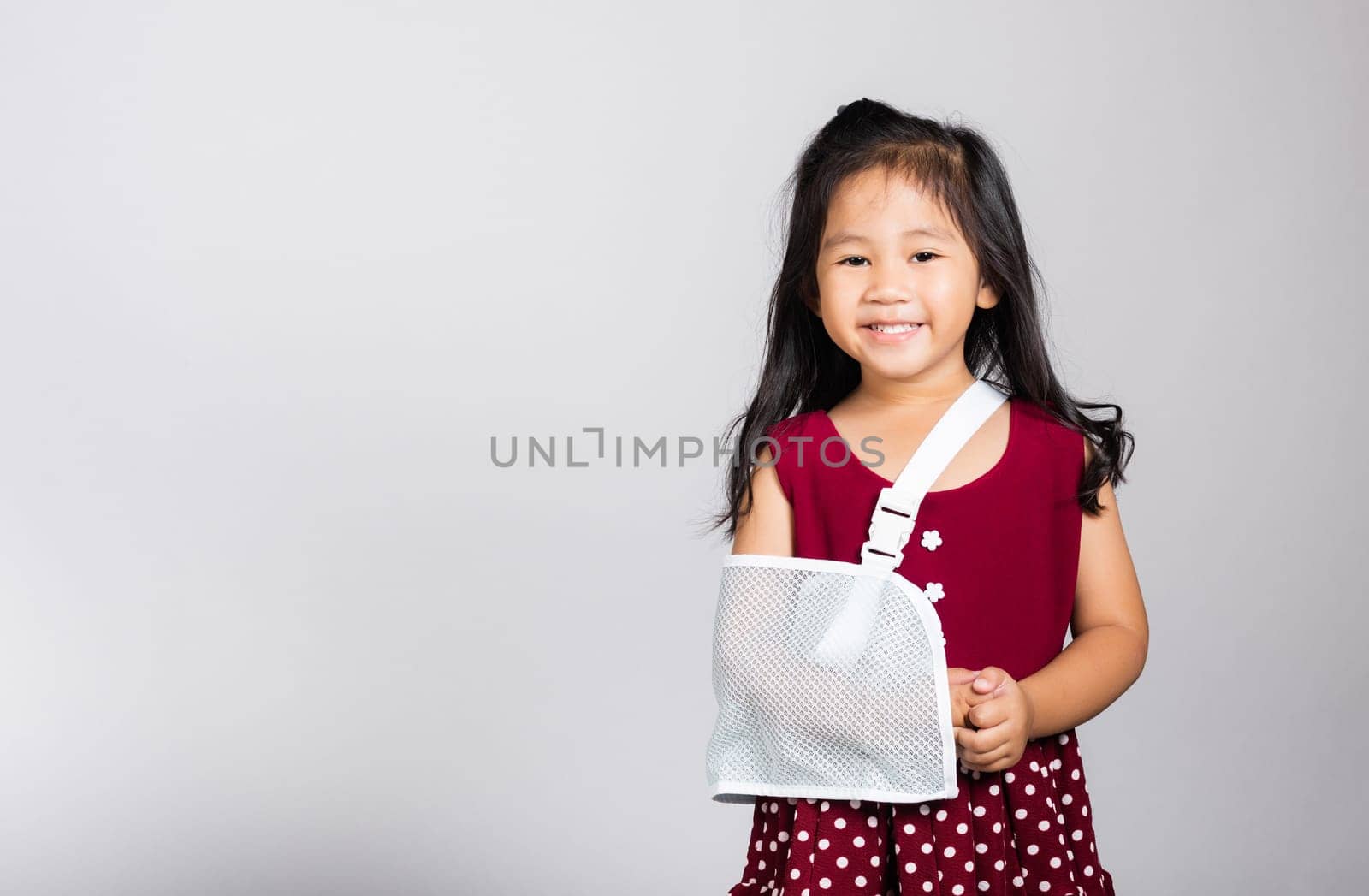 Arm broken. Little cute kid girl 3-4 years old hand bone broken from accident with arm splint in studio shot isolated on white background, Asian children preschool injured after accident, health