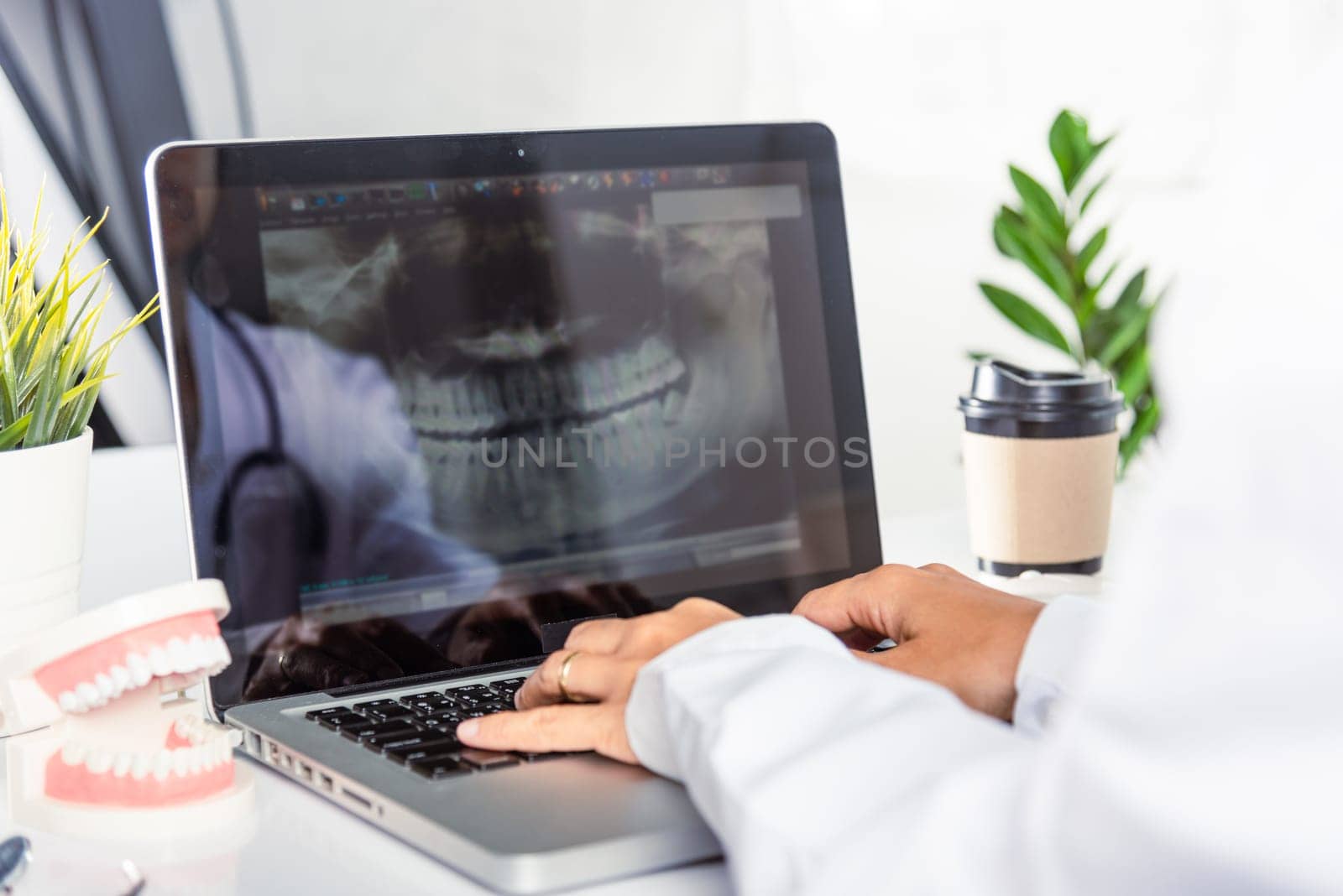 Dentist doctor or nurse in uniform use oral software teeth Xray and typing information medical history form into laptop computer for record document report, tooth model on desk, dentistry concept