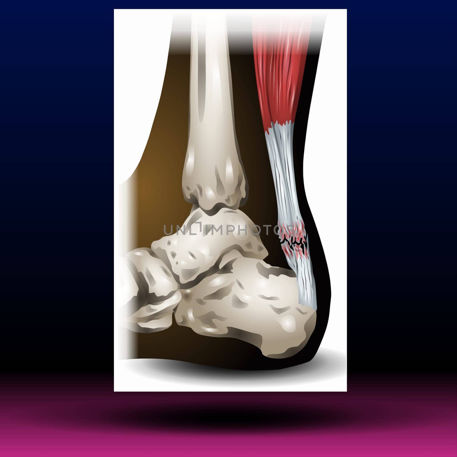 Back Leg Bone - Body Parts - Organ - Pharma