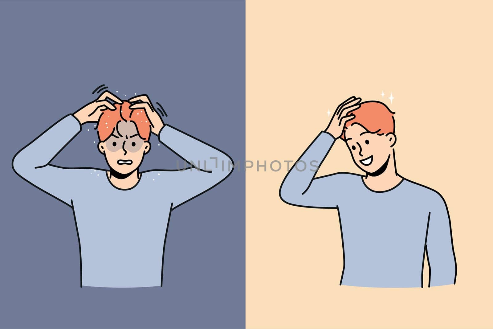 Set of young man suffer from dandruff versus excited with clean healthy hair after treatment. Concept of medical or beauty procedures for haircare. Vector illustration.
