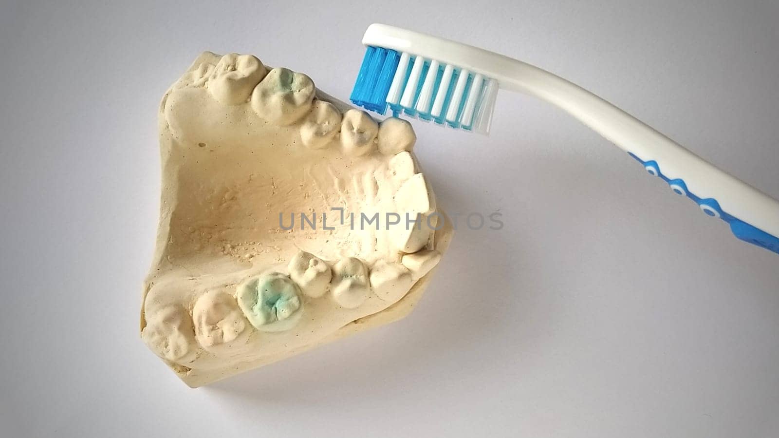 Toothbrush and mock human jaw. Plaster lower jaw. Dental and health care concept. White background. Bright yellow and blue color. Rugged, crooked teeth. Help of the dentist and orthodontist.