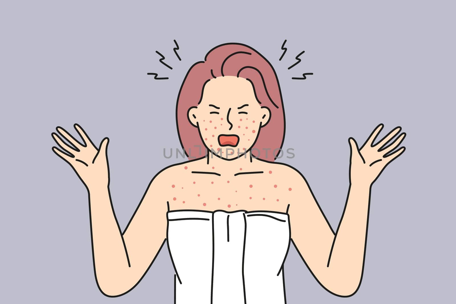 Angry woman in towel shout distressed with red body inflammation. Furious female anxious with allergy reaction or dermatitis. Vector illustration.