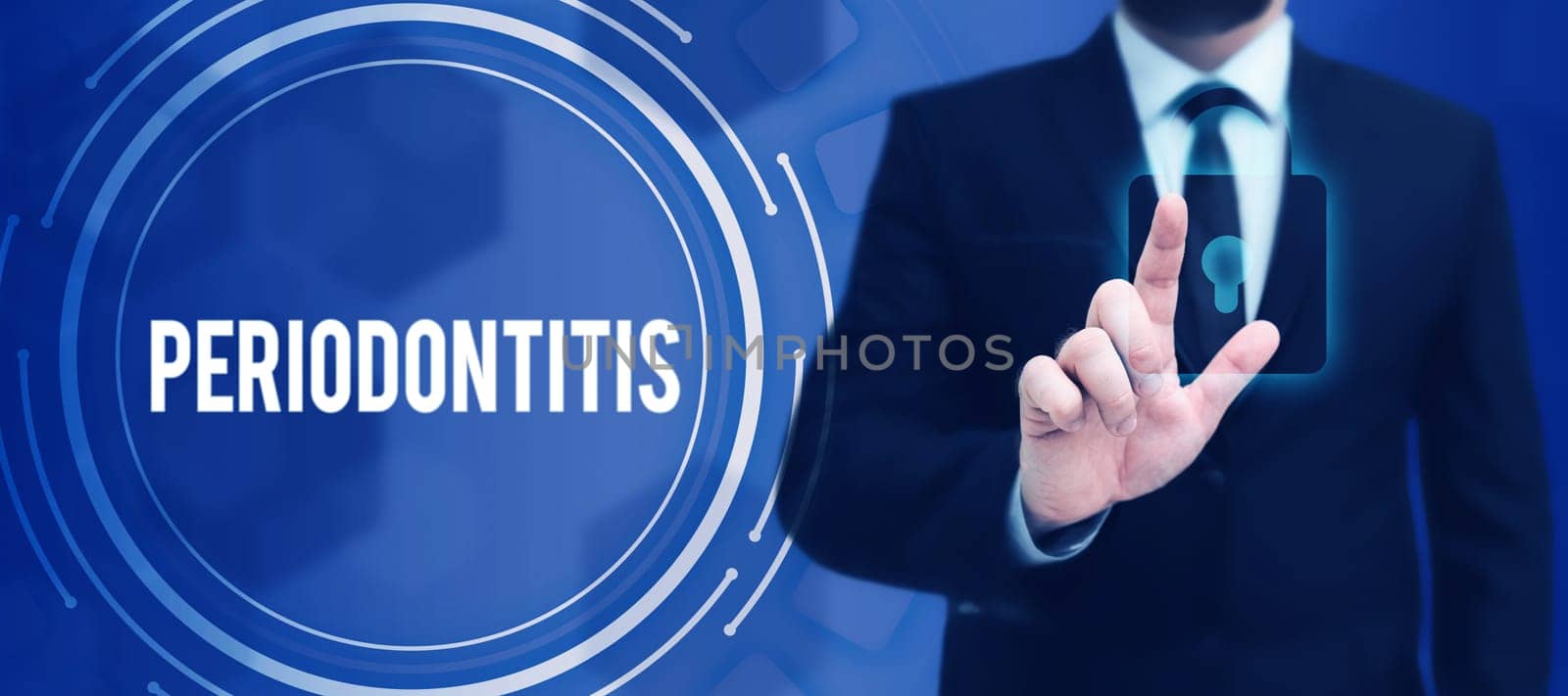 Handwriting text Periodontitis, Internet Concept Swelling of the tissue around the teeth Shrinkage of the gums