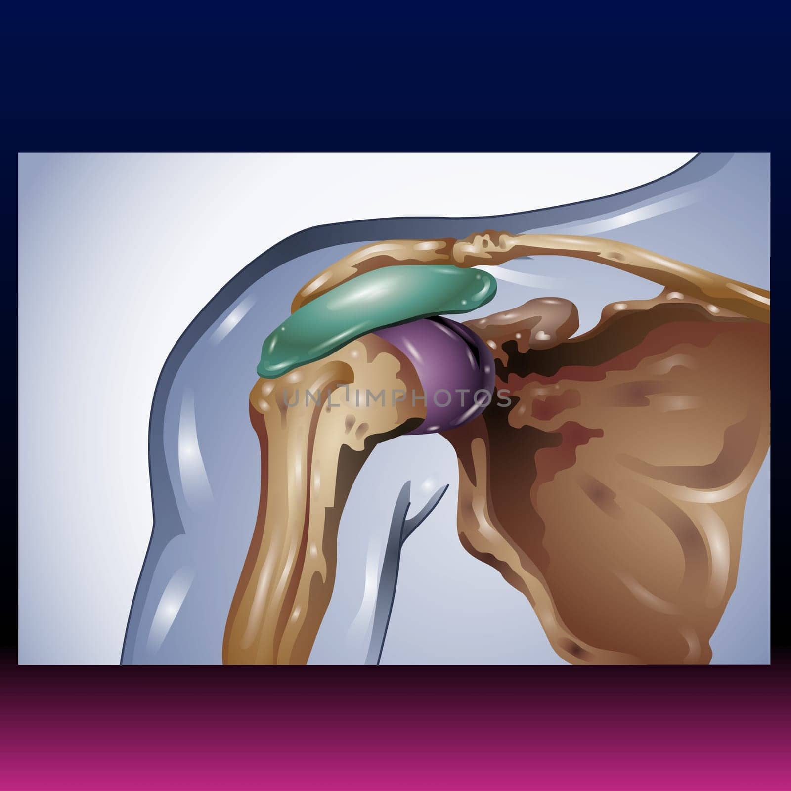 The shoulder is one of the largest and most complex joints in the body. The shoulder joint is formed where the humerus (upper arm bone) fits into the scapula (shoulder blade), like a ball and socket. Vector Illustration