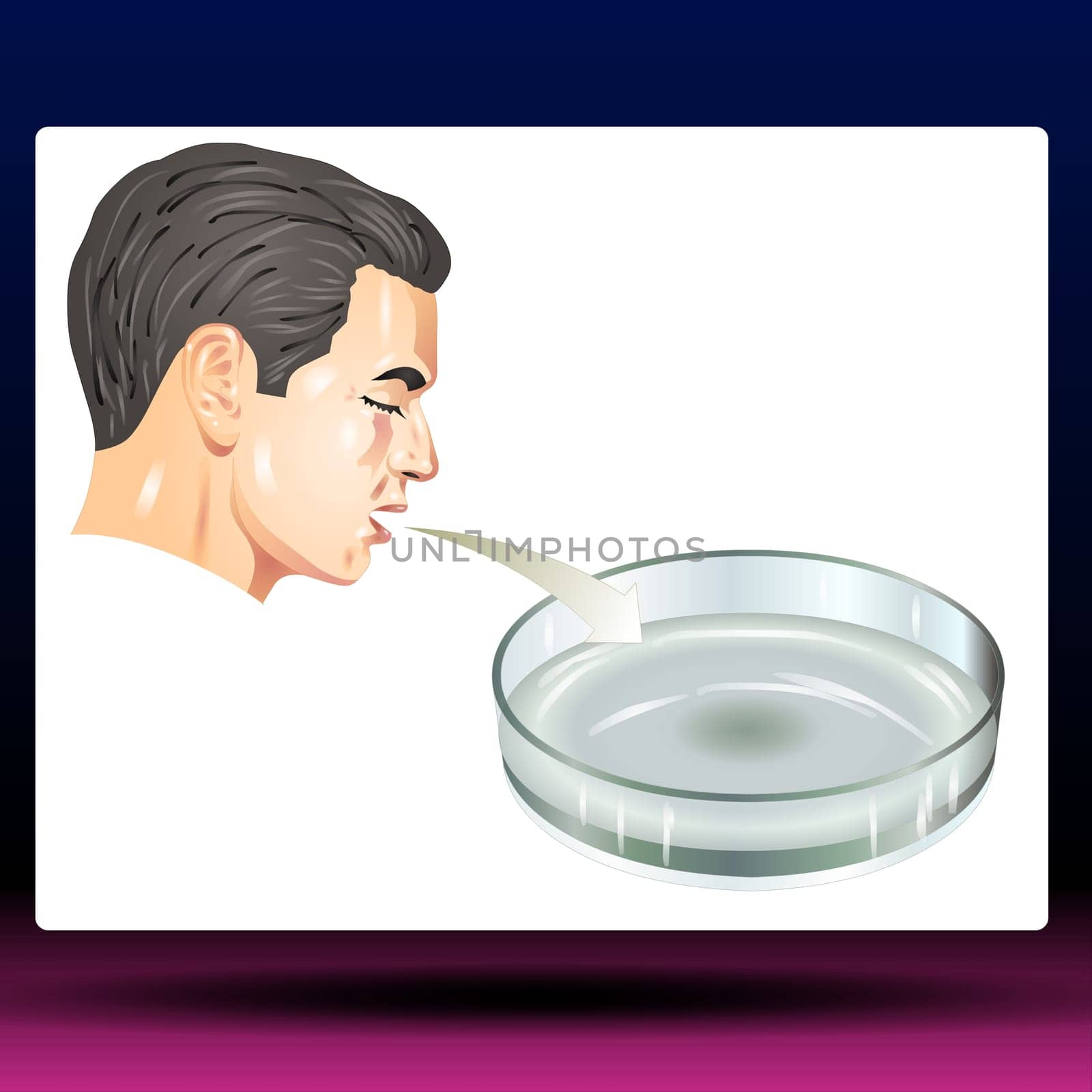 Potassium Hydroxide Test - Vector Illustration