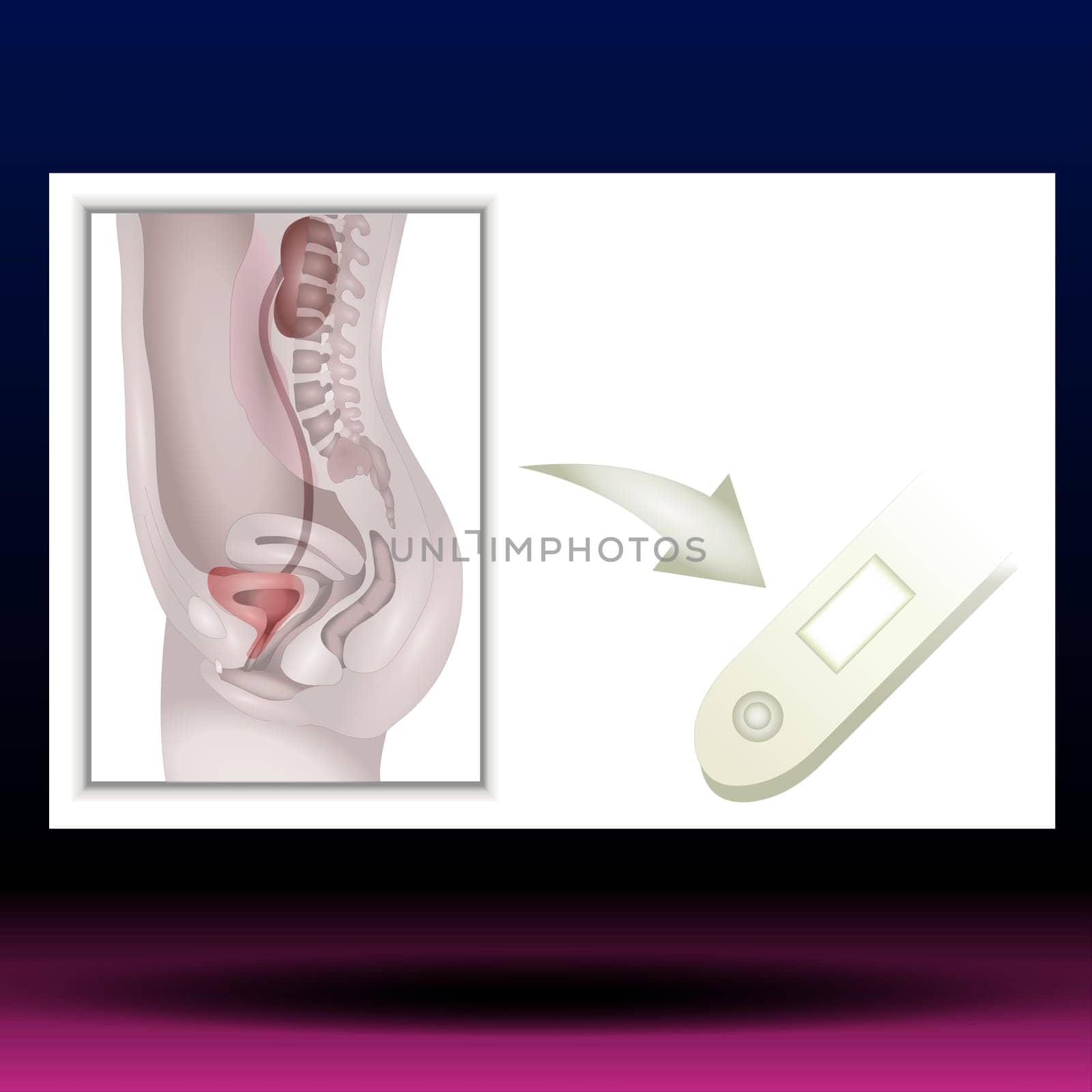 Pregnancy Test - Vector Illustration