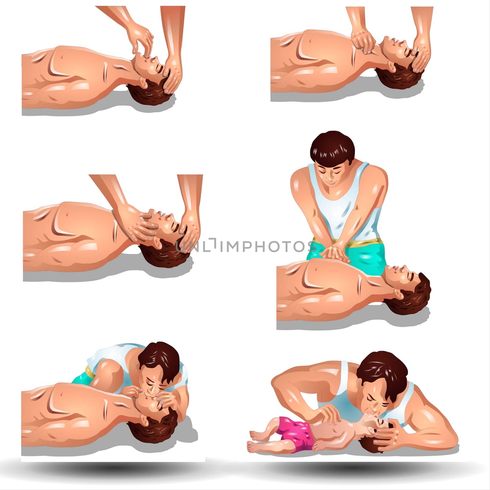 A heart attack is a medical emergency. The average person waits 3 hours before seeking help for symptoms of a heart attack. Many heart attack patients die before they reach a hospital. The sooner the person gets to the emergency room, the better the chance of survival. Prompt medical treatment reduces the amount of heart damage.