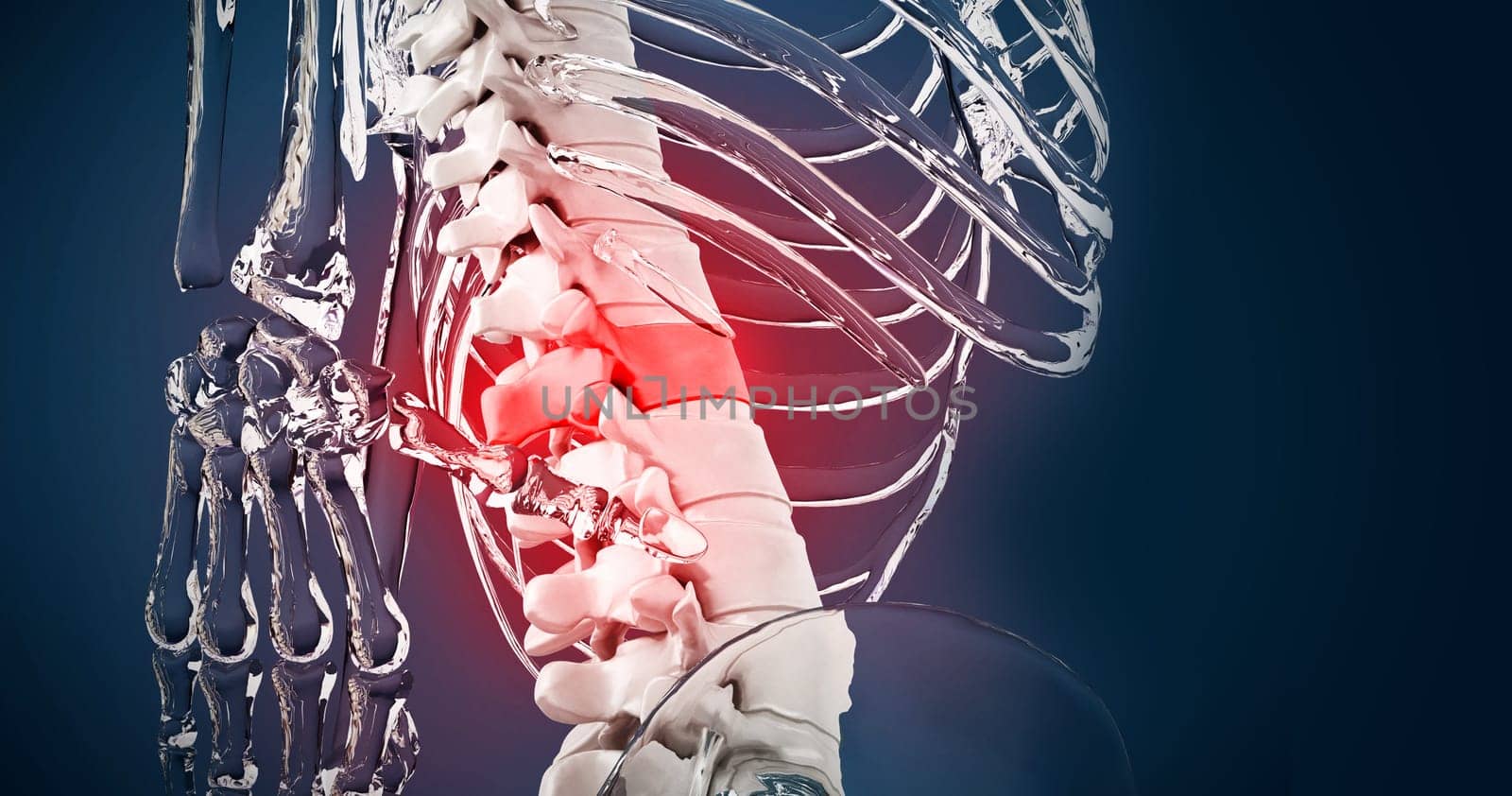 3D illustration showing back pain. 3D illustration.