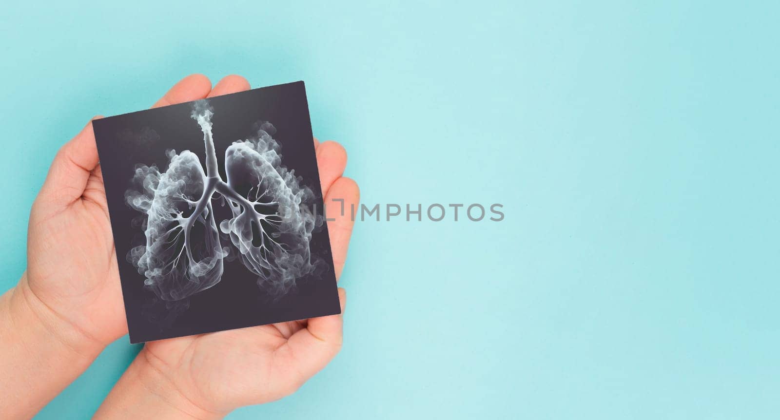 Lung with smoke, x-ray of the organ, world no tobacco day, unhealthy addiction , medical health risk, lung made with generative AI