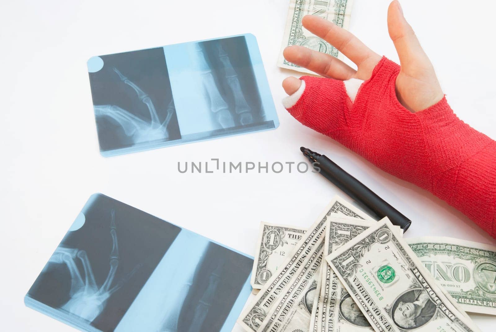Medicine stillife with copyspace. Hand is bandaged in red plaster and splint in oreder to support the healing process.