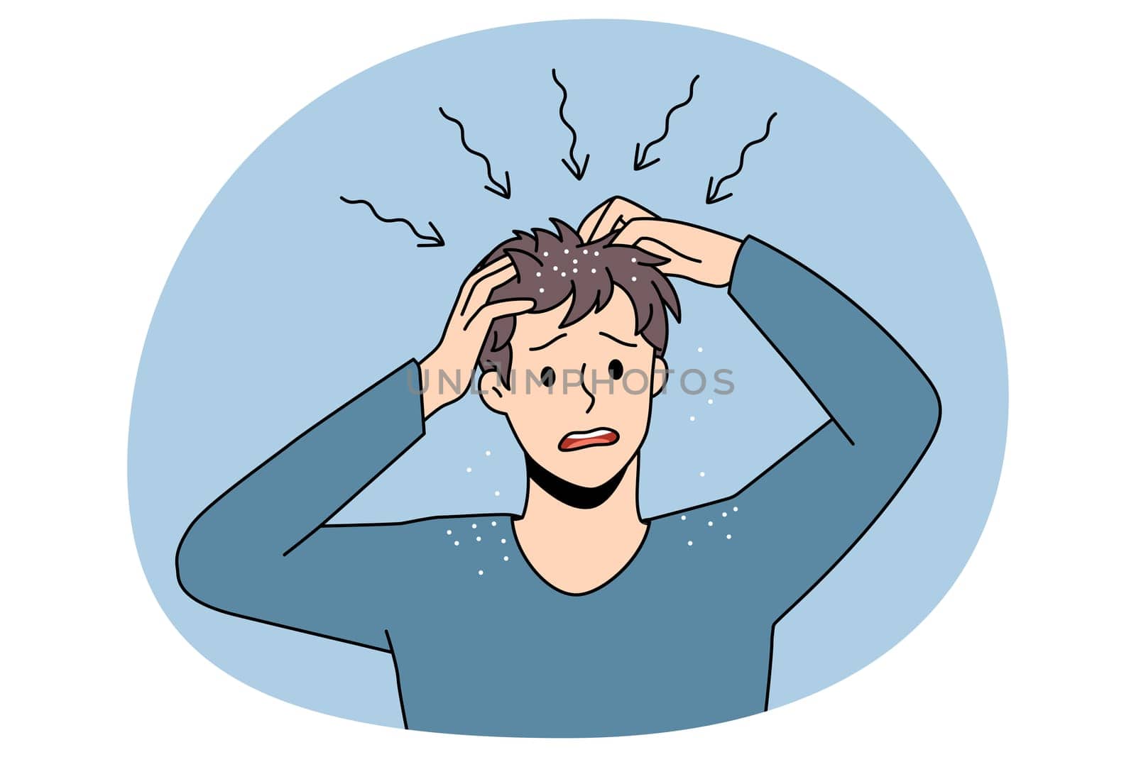 Itchy head and dandruff concept. Stressed irritated man standing and having itchy scalp feeling problems with health and scratching hair vector illustration