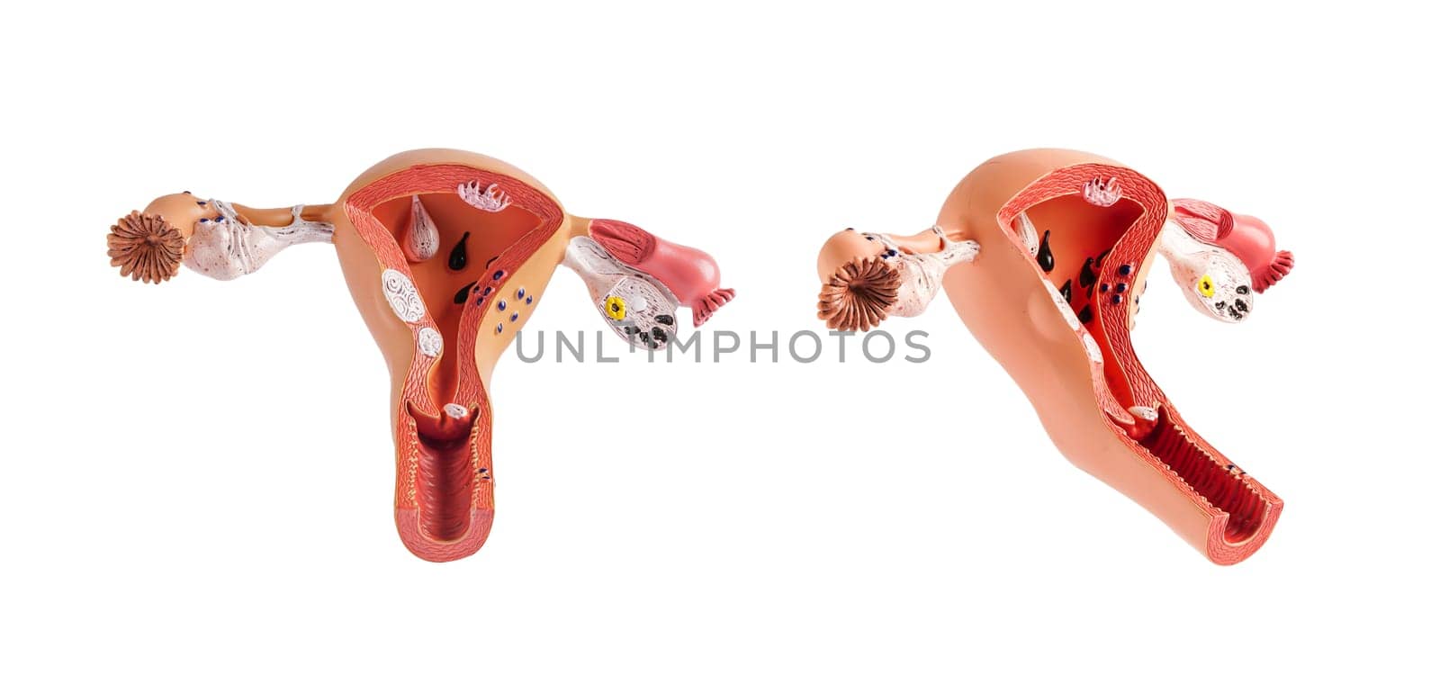 Uterus model isolated on white background, doctor holding anatomy model for study diagnosis and treatment in hospital.