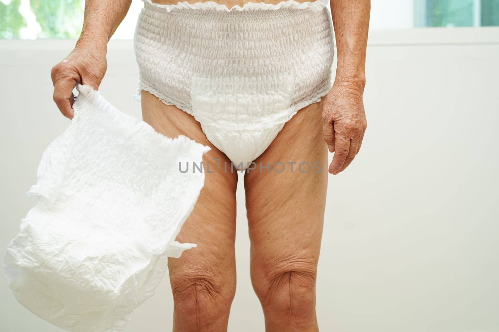 Asian senior woman patient wearing adult incontinence diaper pad in hospital.