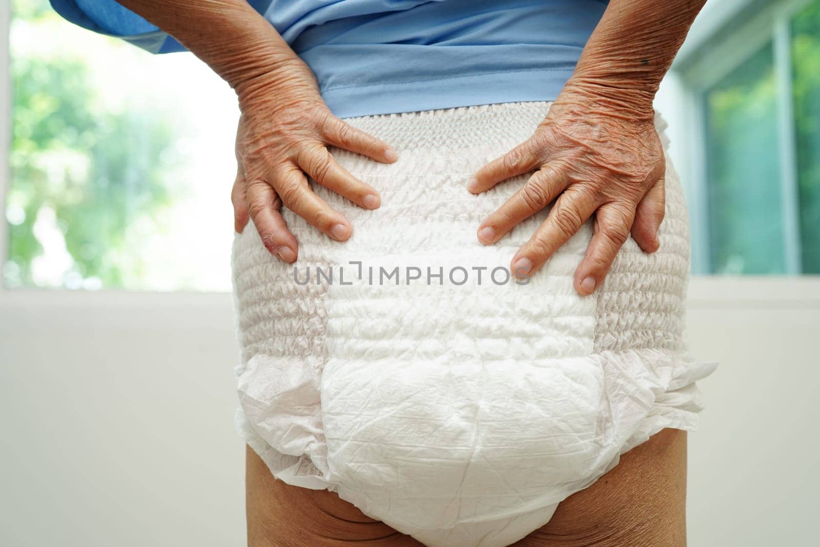 Asian senior woman patient wearing adult incontinence diaper pad in hospital.