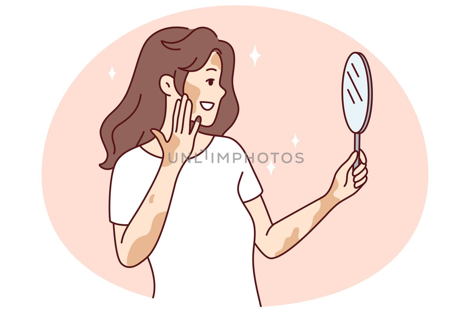 Smiling woman with vitiligo look in mirror feeling body positive. Happy girl with skin disease feel satisfied and optimistic. Skincare and dermatology. Vector illustration.