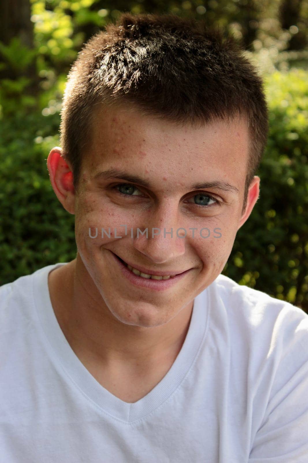 portrait of an adult smiling guy with pimples on his face