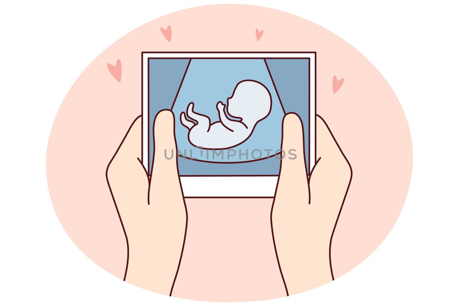 Hands of person holding scan of embryo waiting for baby birth. Future mother with ultrasound picture of baby. Motherhood concept. Vector illustration.