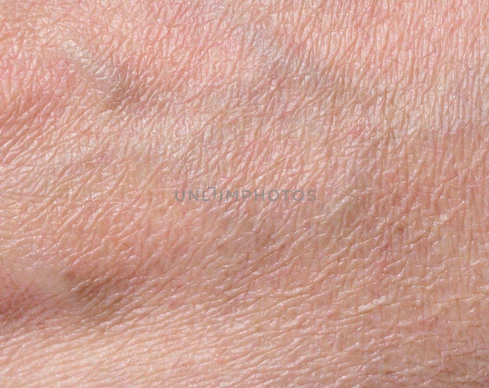 White person skin texture, close up