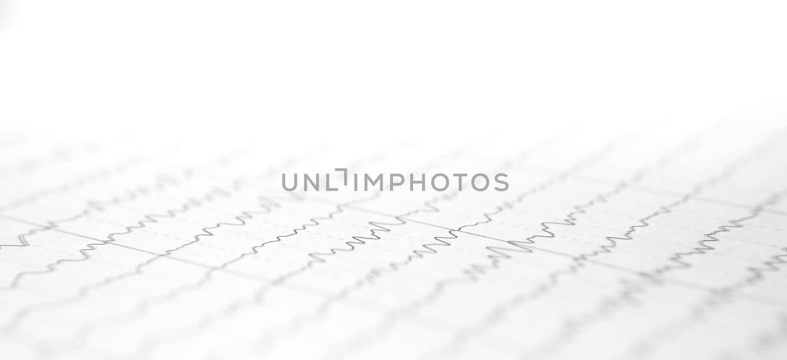 a card with a cardiogram of the heart. High quality photo