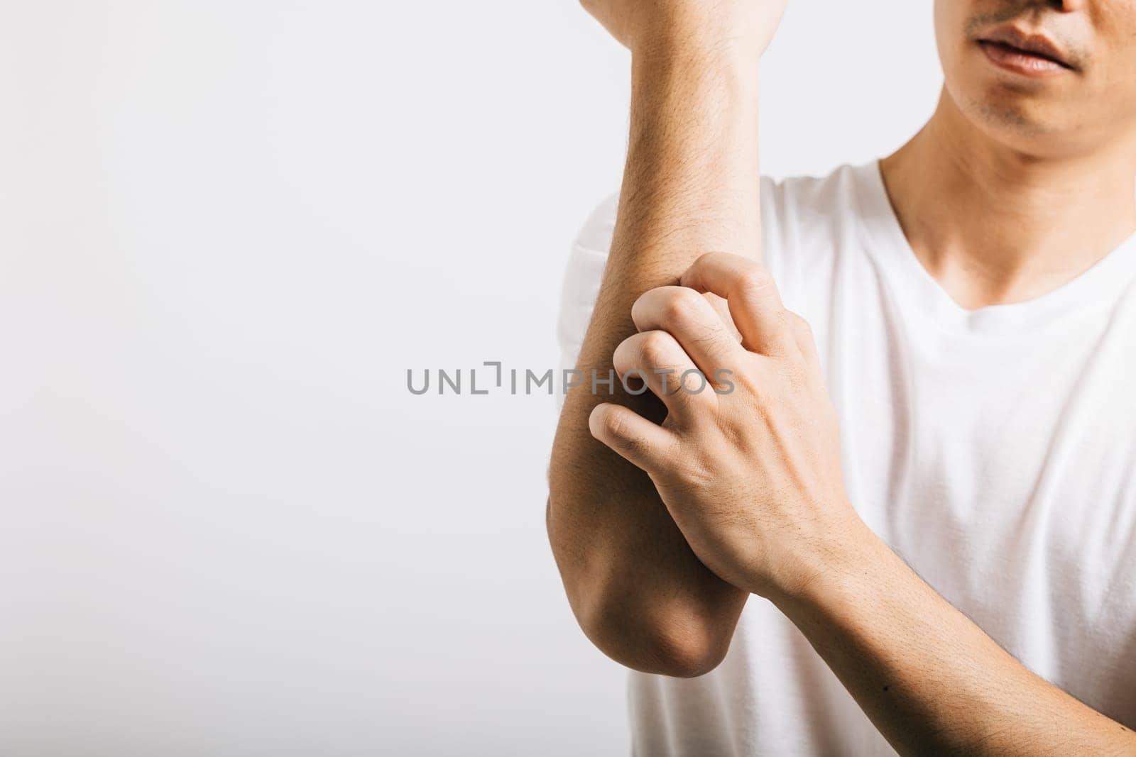 Portrait of unhappy man scratching his arm, dealing with itchiness, potentially from mosquito bite. Studio shot isolated on white, emphasizing skin-related health problems like dermatitis and scabies.
