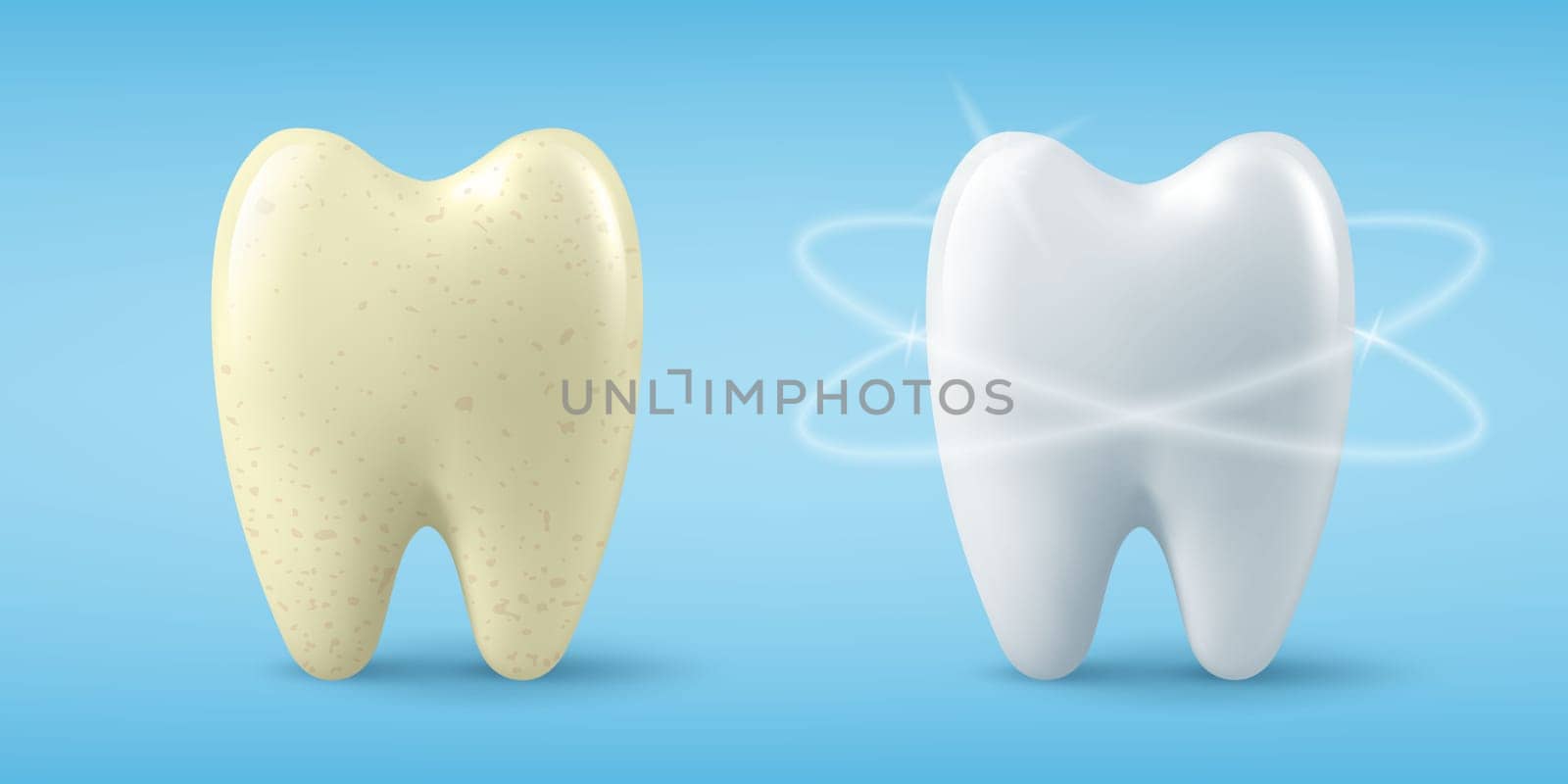 Vector Banner with Realistic Dirty and Clean Tooth. Cleaning Concept, Before, After Hygienic Teeth Cleaning. Dentistry Design for Medical, Toothpaste Advertisement. Healthy Oral Hygiene, Teeth Care.