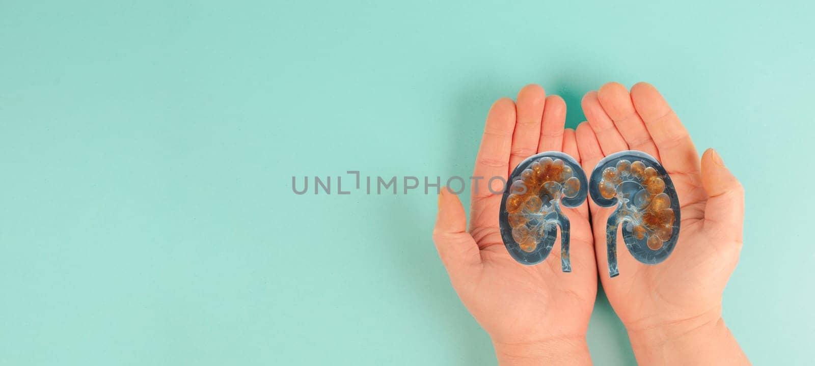 Kidney organ disease, world kidney day, health problems, donation and transplantation, medical issue