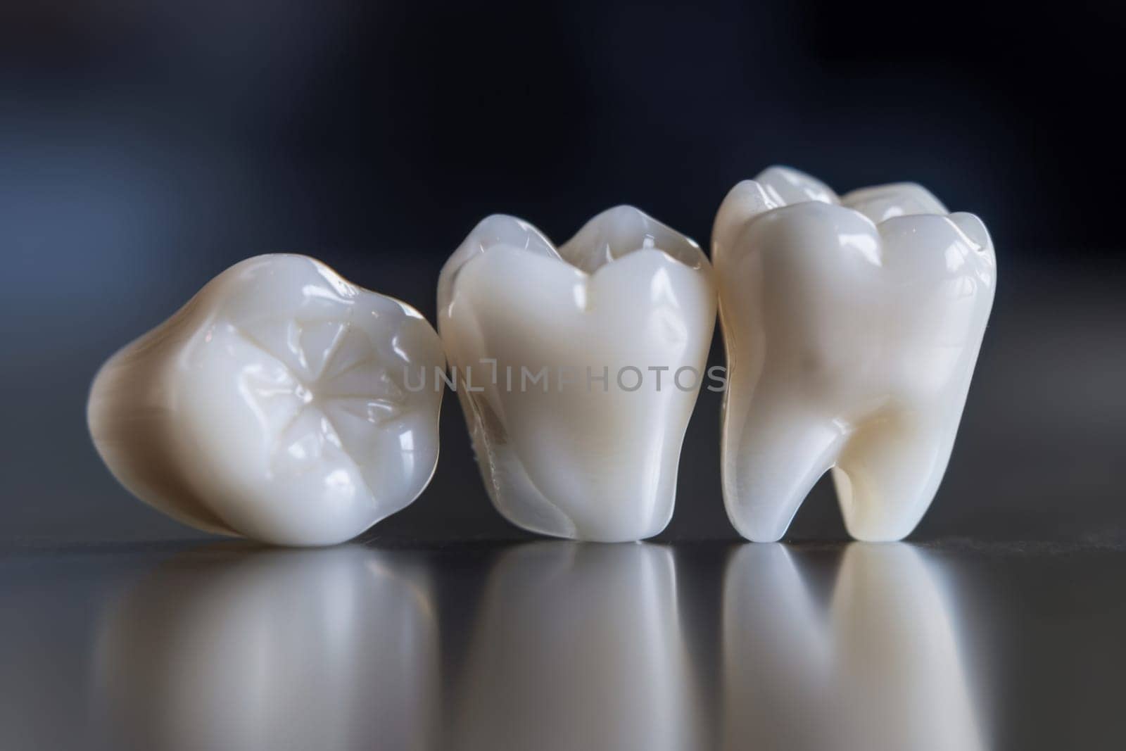A collection of tooth models are meticulously arranged on top of a wooden table. Each model displays different dental conditions and features, providing a visual representation of various aspects of oral health.