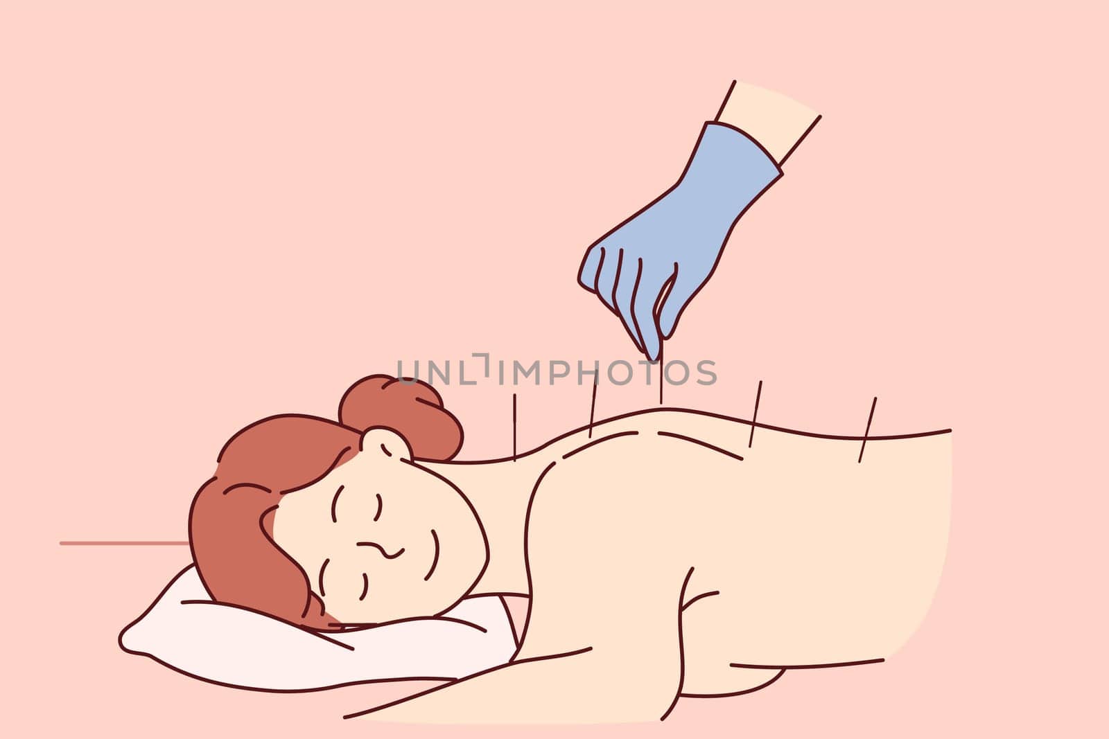 Acupuncture procedure from traditional chinese medicine for woman lying at reception in SPA center. Process of acupuncture and needle therapy allows you to get rid of pain in spine after injury