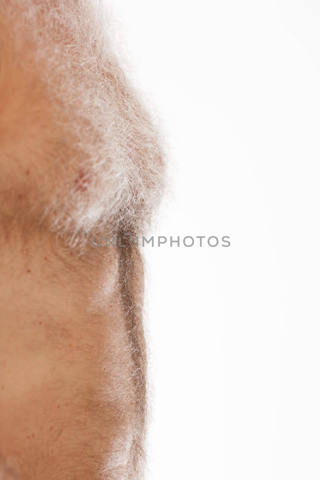 Elderly man's torso with textured skin speaks to the natural aging process
