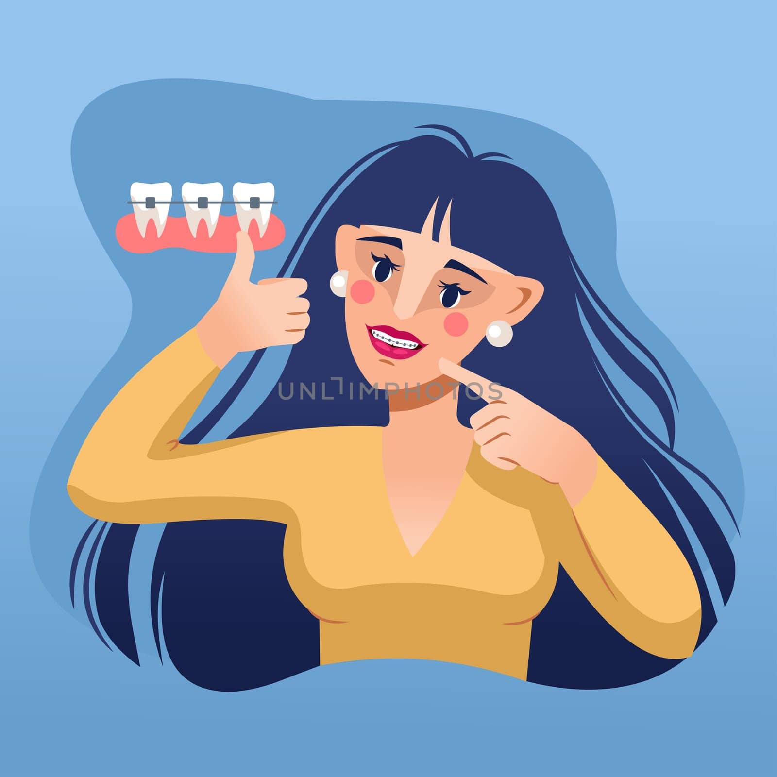 Woman demonstrates dental braces installed by dentist from stomatological clinic to improve smile. Girl with dental braces shows thumbs up giving positive feedback and recommending good orthodontist
