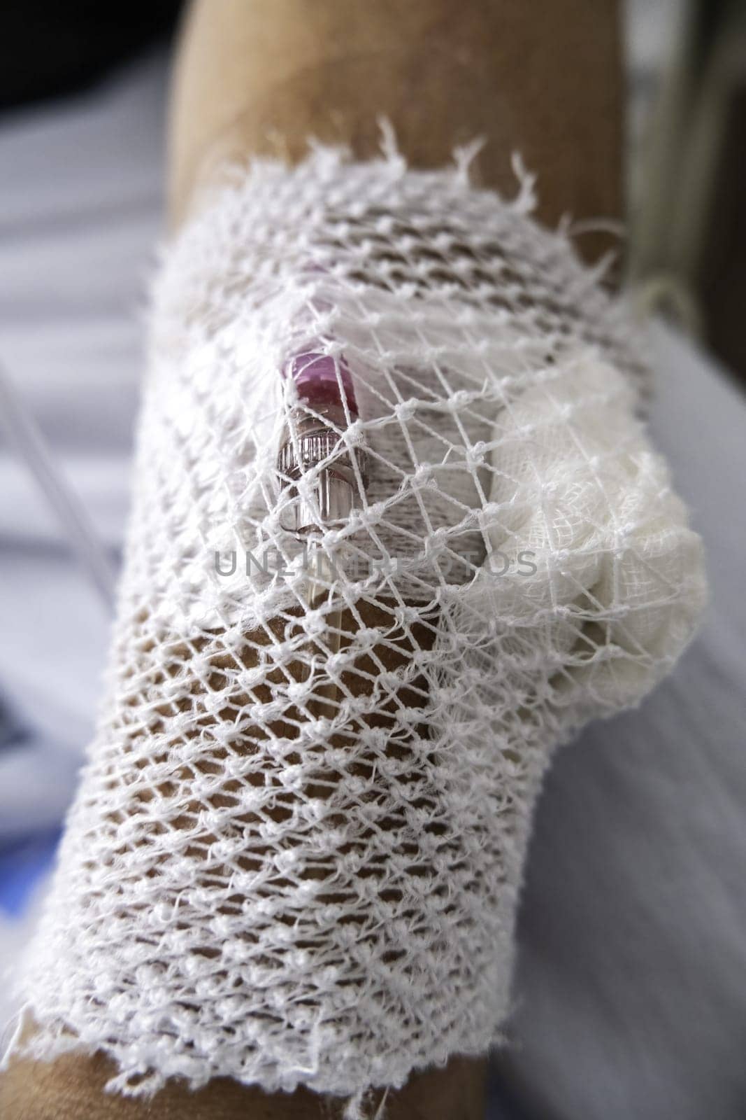 Detail of intravenous medication in a hospital