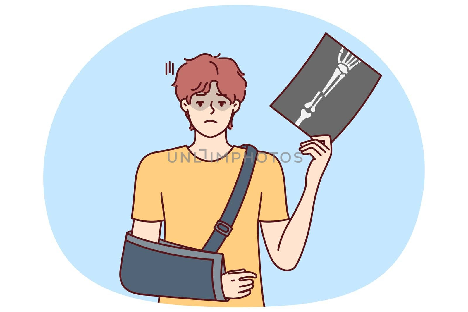 Man injured arm and shows picture of bone with traces of fracture taken by doctor using X-ray machine. Guy injured in car accident has broken arm and needs treatment or rehabilitation