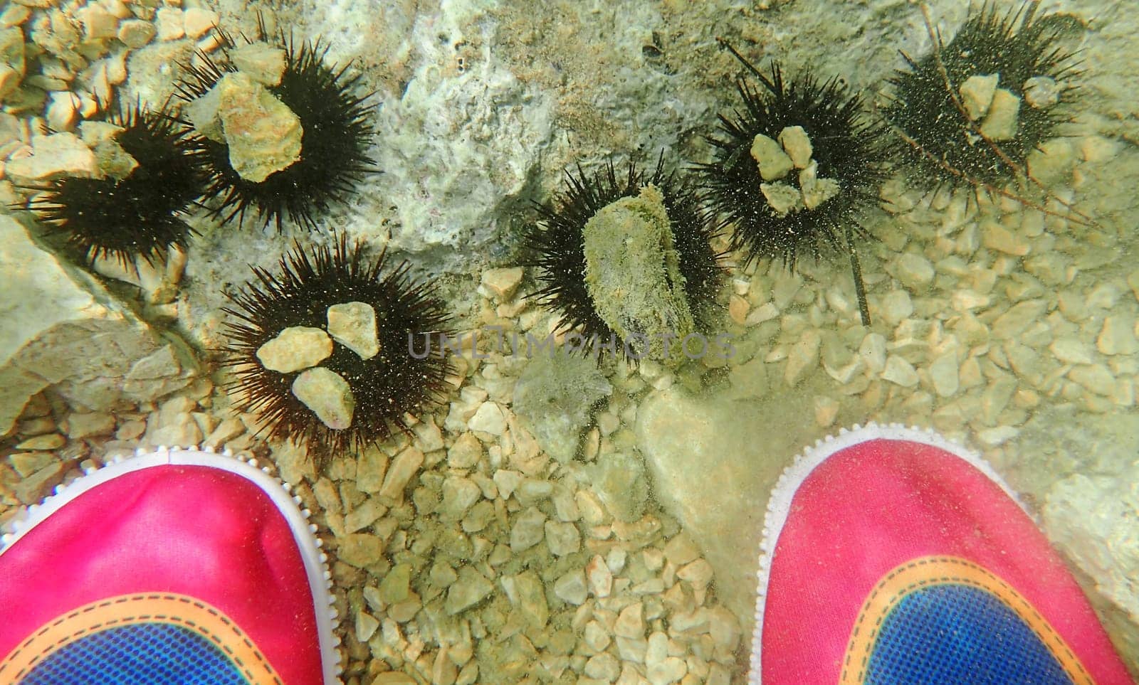 Bathing shoes can protect against injuries from sea urchins in the sea