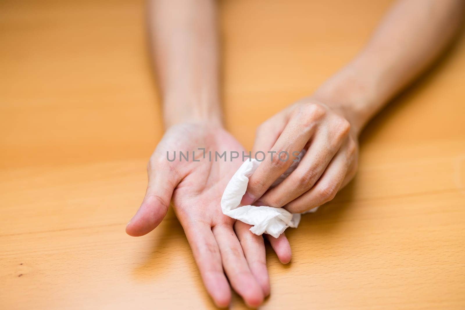 Woman suffer from hand perspiration clean up with tissue