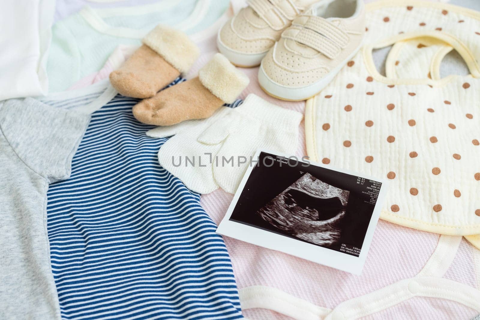 Ultrasound photo with baby clothing