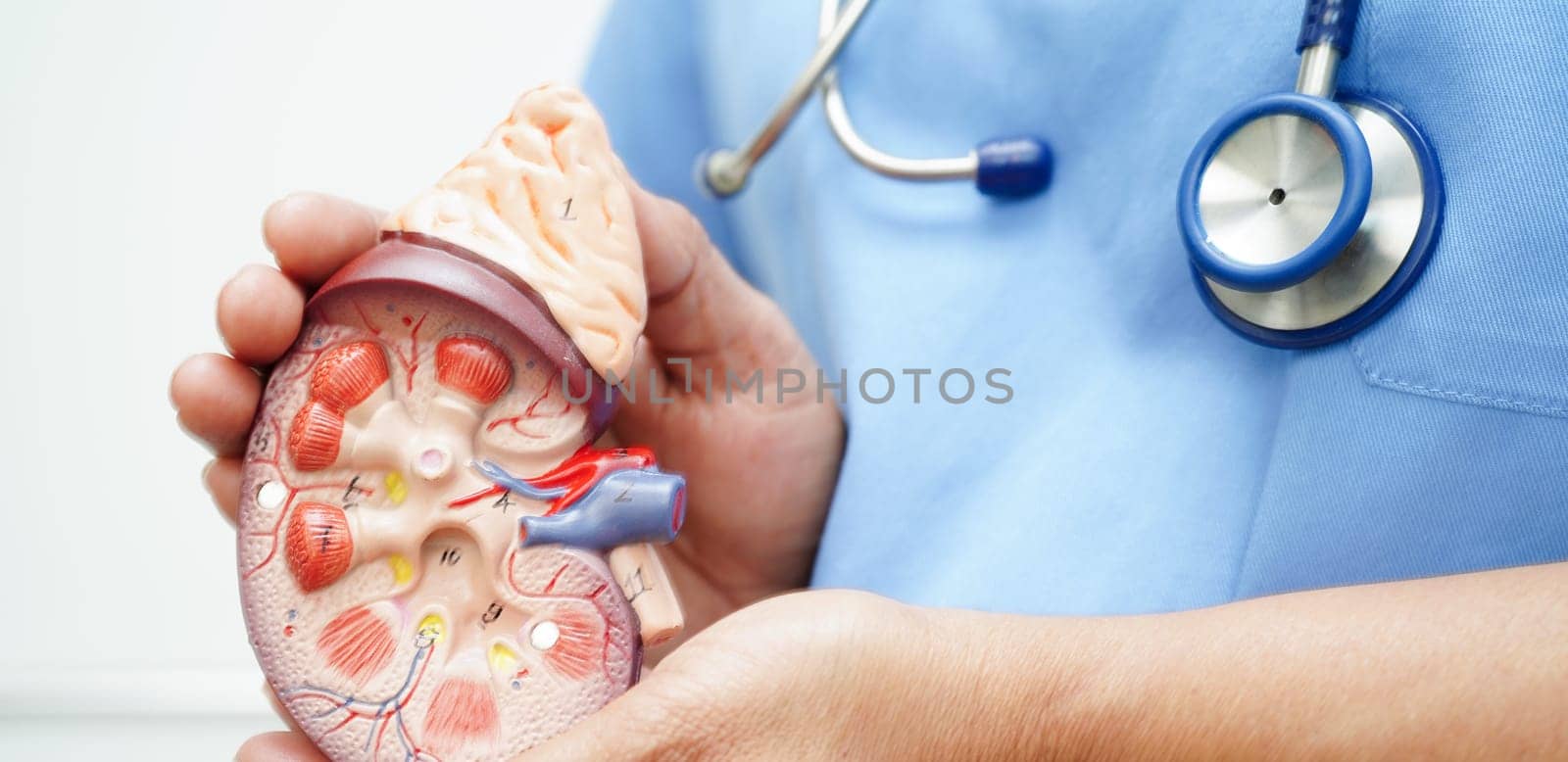 Chronic kidney disease, doctor with model for treatment urinary system, urology, Estimated glomerular filtration rate eGFR.