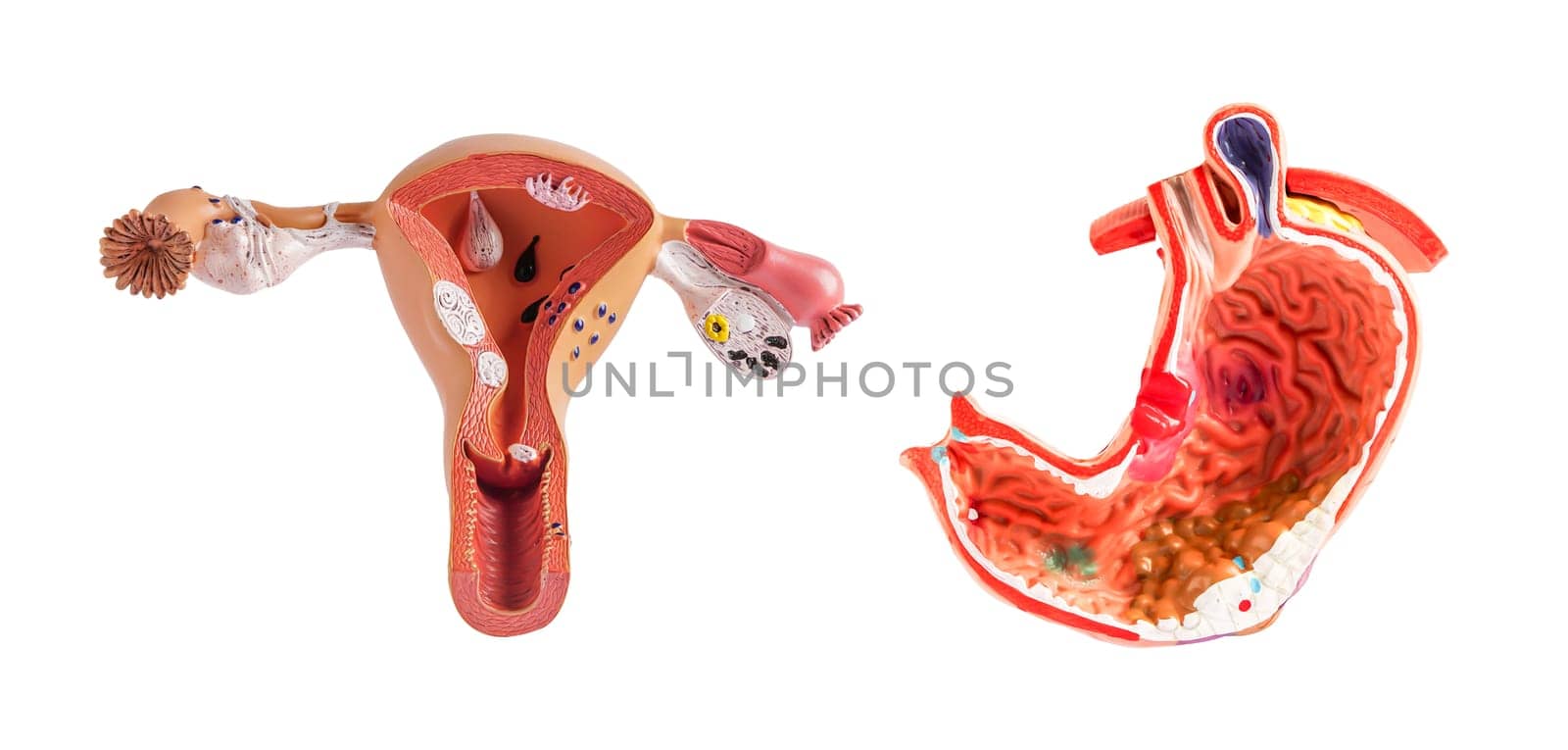 Uterus and stomach model isolated on white background, doctor holding anatomy model for study diagnosis and treatment in hospital.