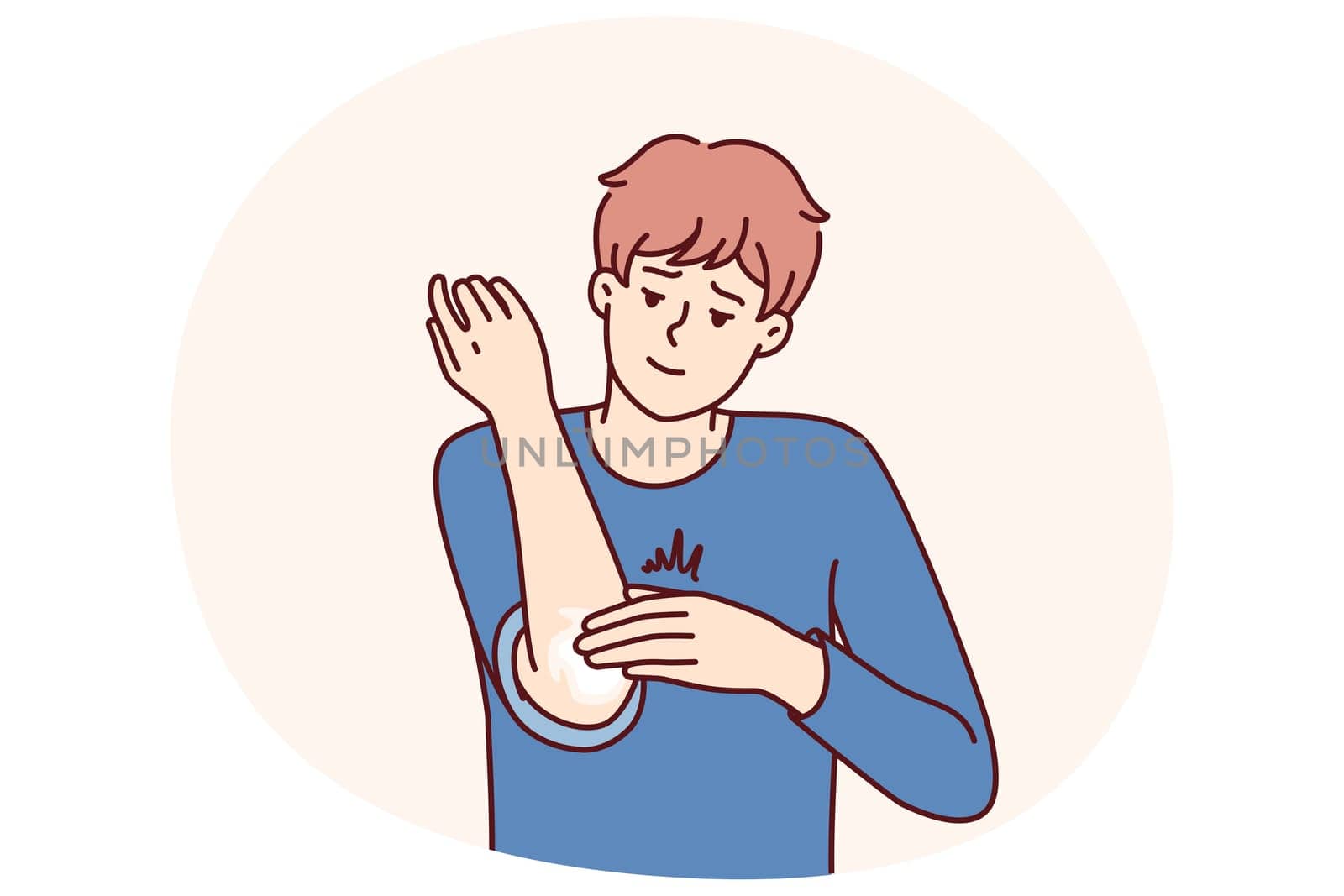 Man smears elbow with healing ointment after bruise or skin problems and acne. Young guy uses analgesic dermatological ointment to treat elbow joint and take care of skin in need of moisture