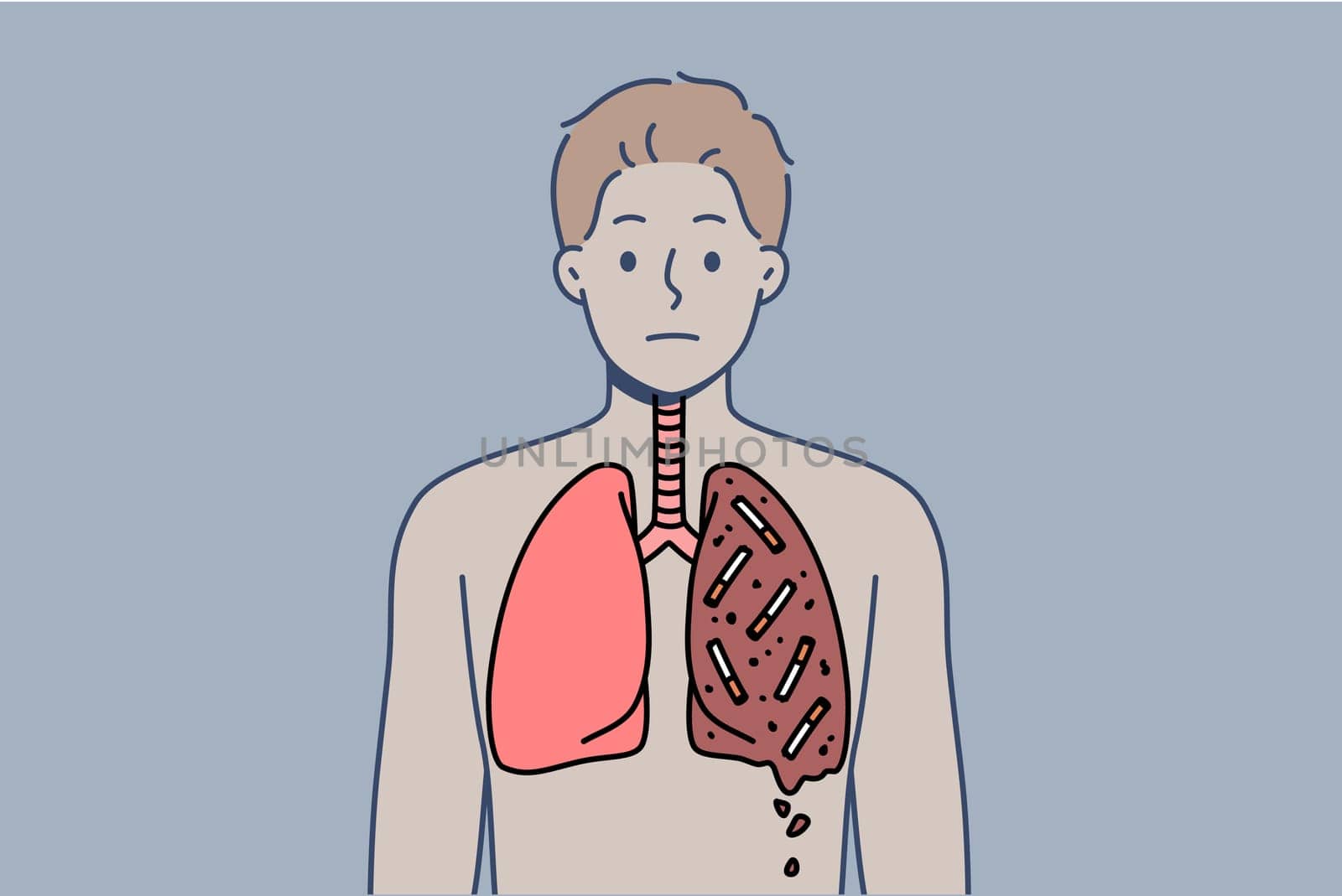 Man smoker with destroyed lungs is forced to suffer due to addiction of tobacco and nicotine. Guy who smokes needs surgery due to smoking for long time and lack of willpower for fight bad habit.