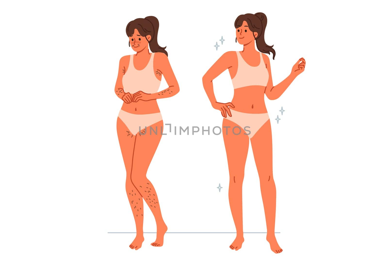 Girl uses depilation and laser hair removal, demonstrating result of visit to cosmetologist. Young woman recommends depilation of legs and face or bikini area using sugaring or hot wax