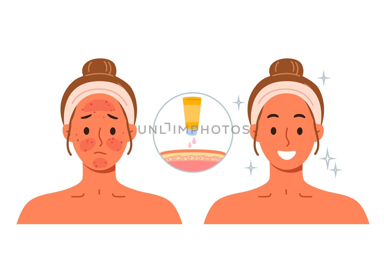 Sunscreen that protects skin from burns and solar radiation, next to girls demonstrating results before and after. Sunscreen for solarium visitors or tourists vacationing in tropical countries